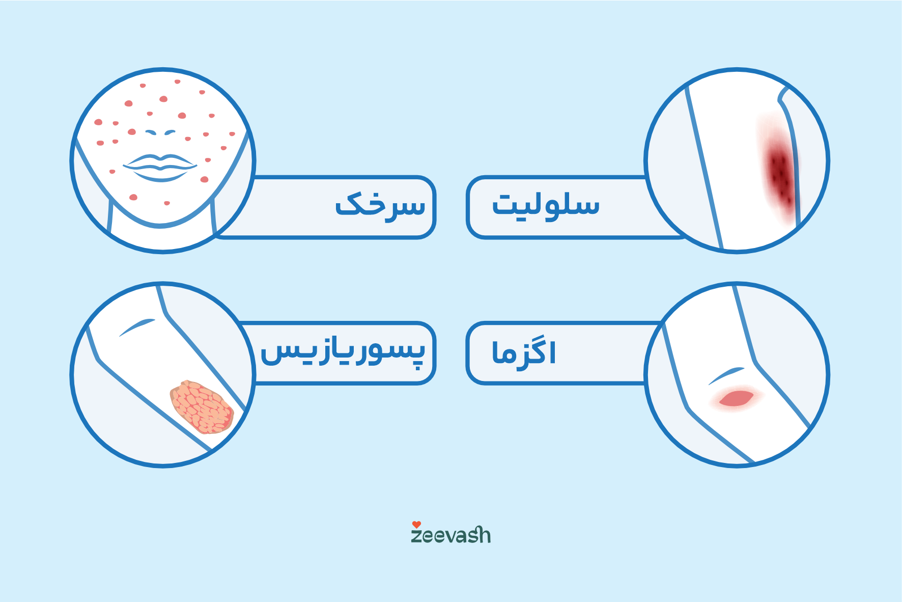 عکس بیماری های پوستی - اگزما پسوریازیس سلولیت سرخک
